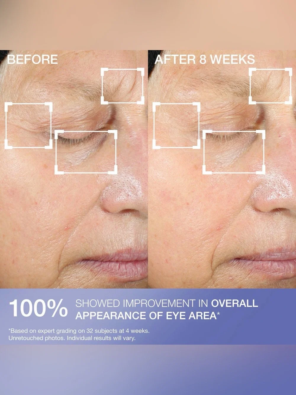 NEW! StriVectin Intensive Eye Concentrate